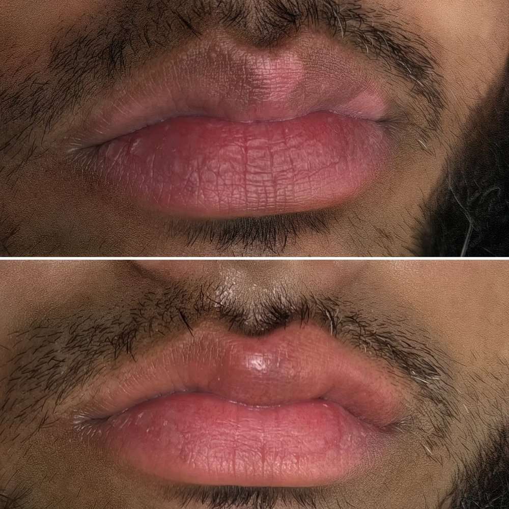 Before and after vitiligo camouflage by Kate Dark